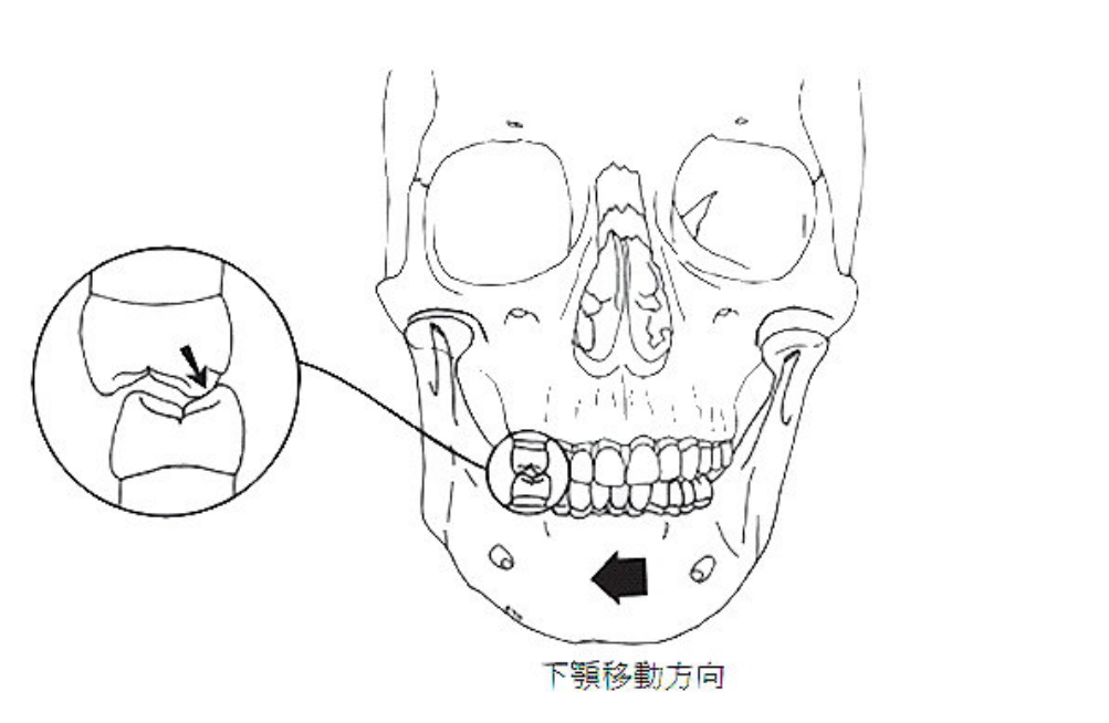 第48題官方原題影像 1