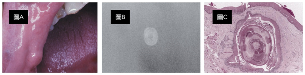第14題官方原題影像 1