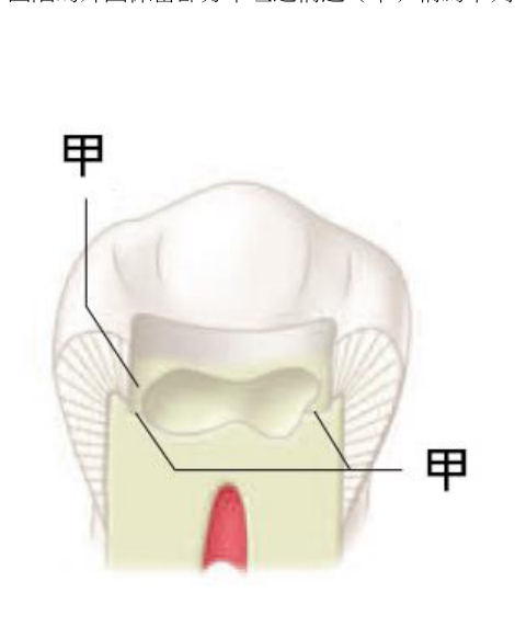 第44題官方原題影像 1