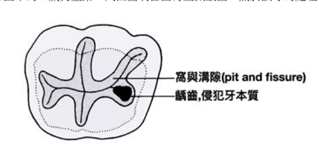 第38題官方原題影像 1