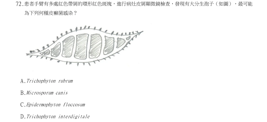 113年第1次醫事檢驗師國考 微生物學與臨床微生物學(包括細菌與黴菌) 第72題原 PDF 題面截圖(含圖像、公式或選項):患者手臂有多處紅色帶屑的環形紅色斑塊,進行病灶皮屑顯微鏡檢查,發現有大分生孢子(如圖),最可能為下列何種皮癬菌感染?