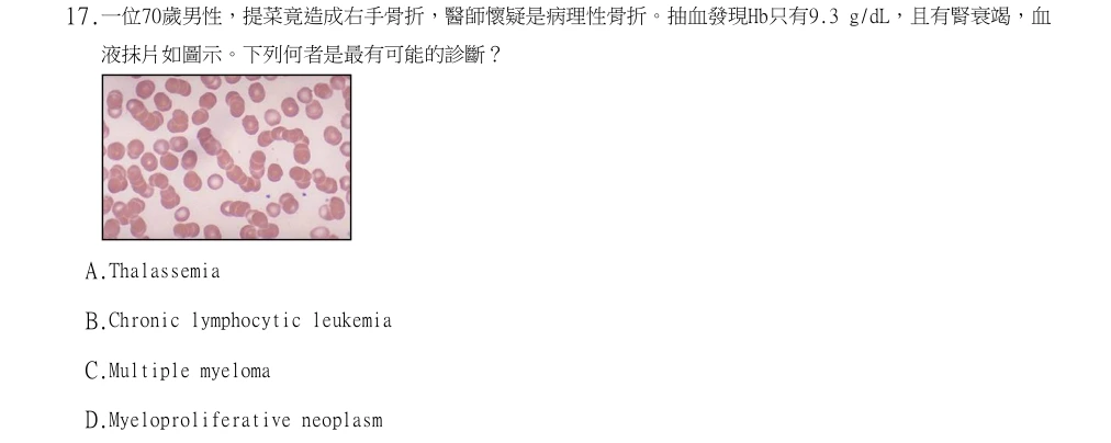 113年第2次醫事檢驗師國考 臨床血液學與血庫學 第17題原 PDF 題面截圖(含圖像、公式或選項):一位70歲男性,提菜竟造成右手骨折,醫師懷疑是病理性骨折。抽血發現Hb只有9.3 g/dL,且有腎衰竭,血液抹片如圖示。下列何者是最有可能的診斷?