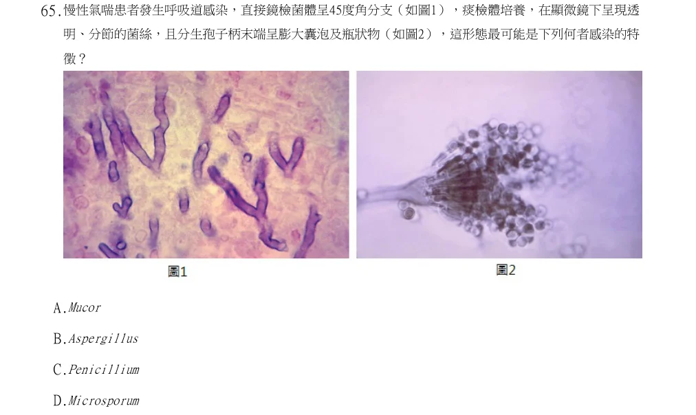 113年第2次醫事檢驗師國考 微生物學與臨床微生物學(包括細菌與黴菌) 第65題原 PDF 題面截圖(含圖像、公式或選項):慢性氣喘患者發生呼吸道感染,直接鏡檢菌體呈45度角分支(如圖1),痰檢體培養,在顯微鏡下呈現透明、分節的菌絲,且分生孢子柄末端呈膨大囊泡及瓶狀物(如圖2),這形態最可能是下列何者感染的特徵?