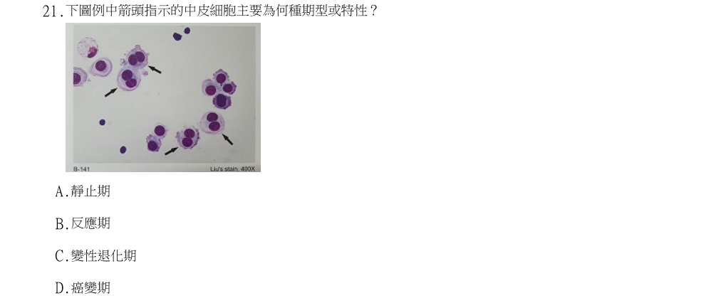 113年第2次醫事檢驗師國考 醫學分子檢驗學與臨床鏡檢學(包括寄生蟲學) 第21題原 PDF 題面截圖(含圖像、公式或選項):下圖例中箭頭指示的中皮細胞主要為何種期型或特性?