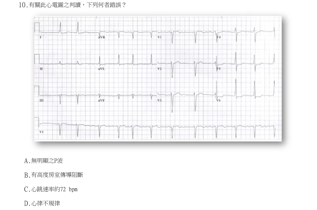 113年第2次醫事檢驗師國考 臨床生理學與病理學 第10題原 PDF 題面截圖(含圖像、公式或選項):有關此心電圖之判讀,下列何者錯誤?