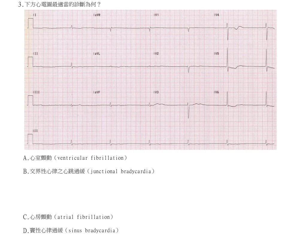113年第2次醫事檢驗師國考 臨床生理學與病理學 第3題原 PDF 題面截圖(含圖像、公式或選項):下方心電圖最適當的診斷為何?