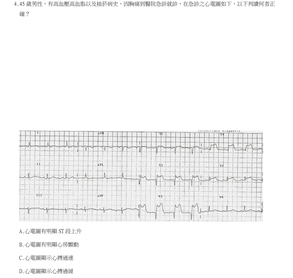 114年第1次醫事檢驗師國考 臨床生理學與病理學 第4題原 PDF 題面截圖(含圖像、公式或選項):45 歲男性,有高血壓高血脂以及抽菸病史,因胸痛到醫院急診就診,在急診之心電圖如下,以下判讀何者正確?
