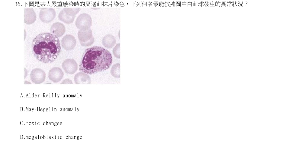 114年第2次醫事檢驗師國考 臨床血液學與血庫學 第36題原 PDF 題面截圖(含圖像、公式或選項):下圖是某人嚴重感染時的周邊血抹片染色,下列何者最能敘述圖中白血球發生的異常狀況?