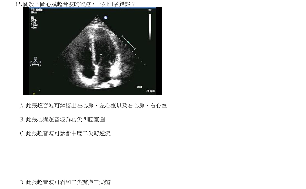 114年第2次醫事檢驗師國考 臨床生理學與病理學 第32題原 PDF 題面截圖(含圖像、公式或選項):關於下圖心臟超音波的敘述,下列何者錯誤?