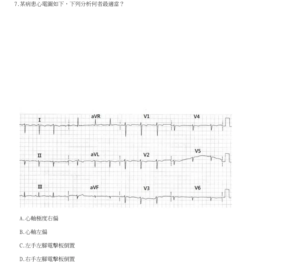 114年第2次醫事檢驗師國考 臨床生理學與病理學 第7題原 PDF 題面截圖(含圖像、公式或選項):某病患心電圖如下,下列分析何者最適當?