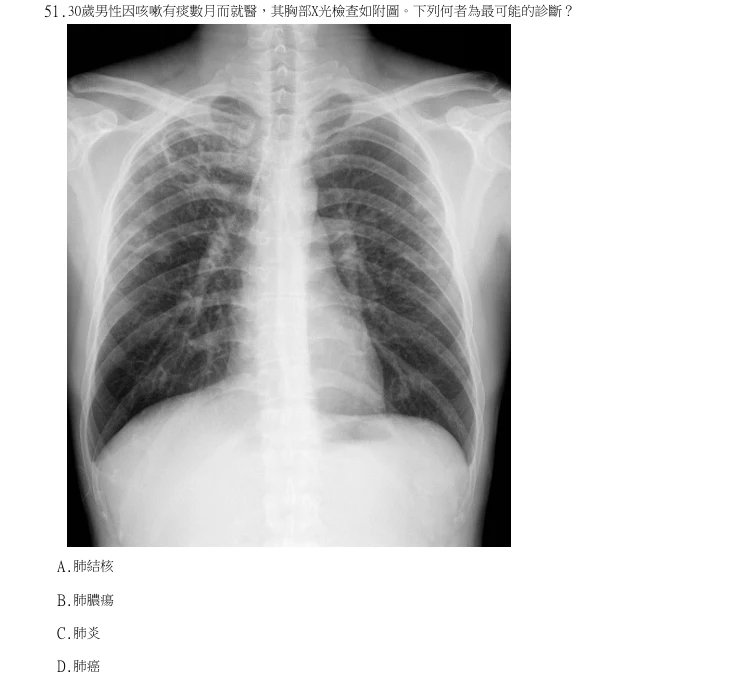 第51題官方原題影像 1