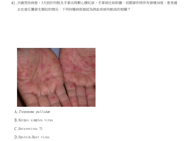 第41題官方原題影像 1