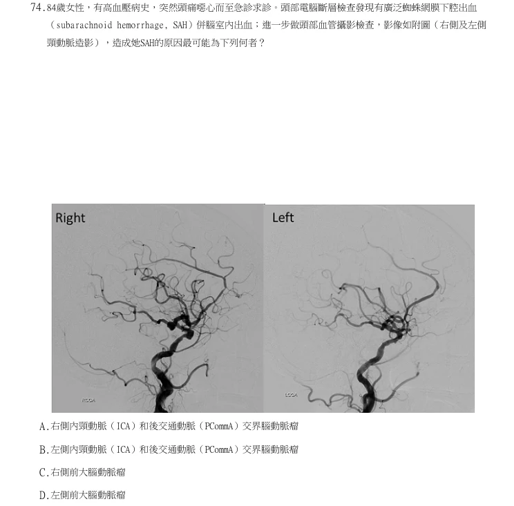 第74題官方原題影像 1