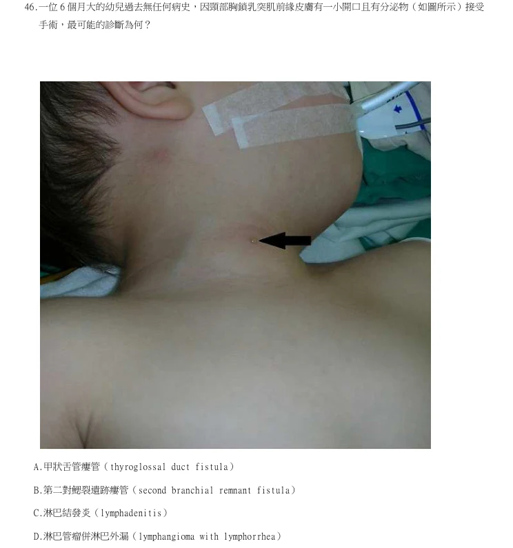 第46題官方原題影像 1