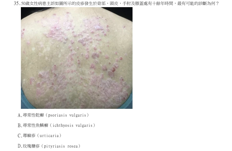 第35題官方原題影像 1