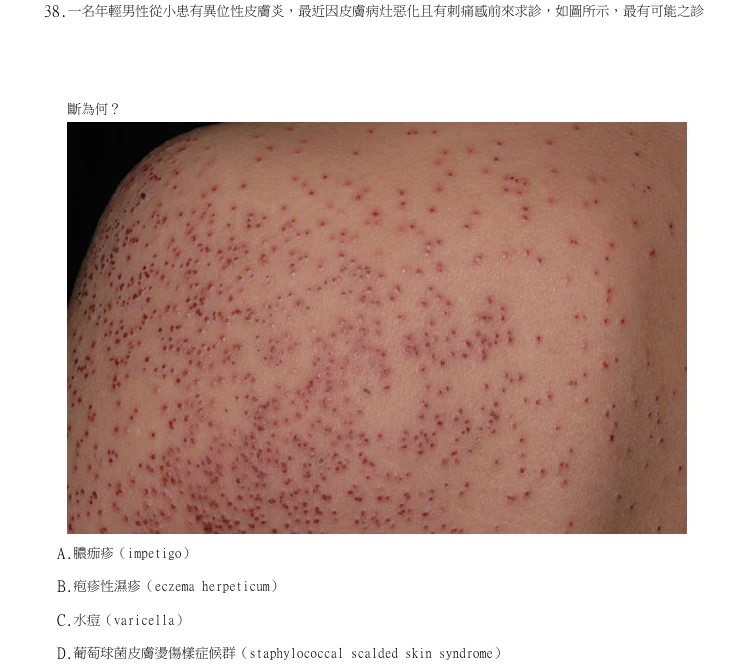 第38題官方原題影像 1