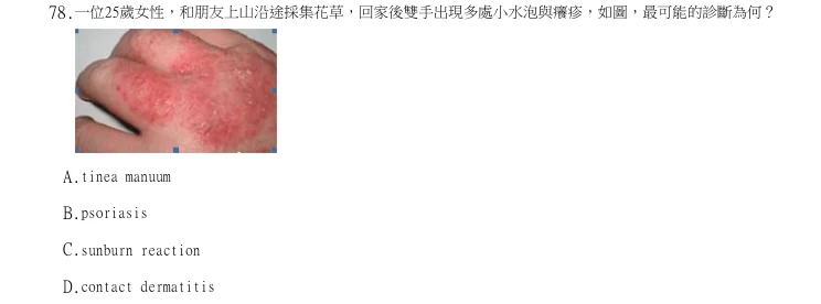 第78題官方原題影像 1