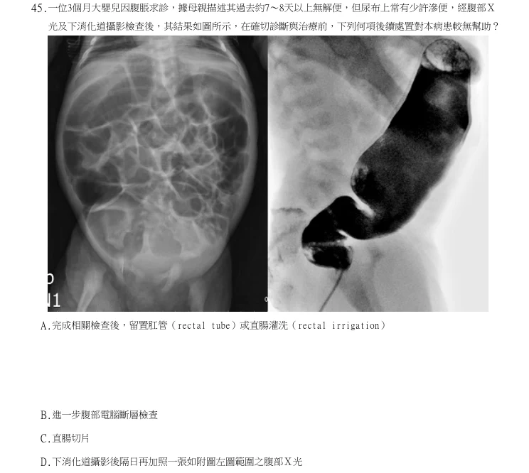 第45題官方原題影像 1