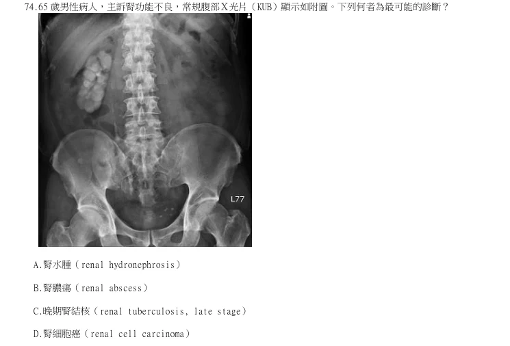 第74題官方原題影像 1