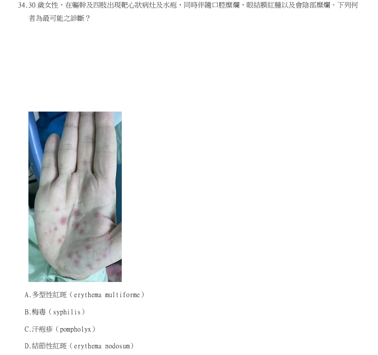 第34題官方原題影像 1