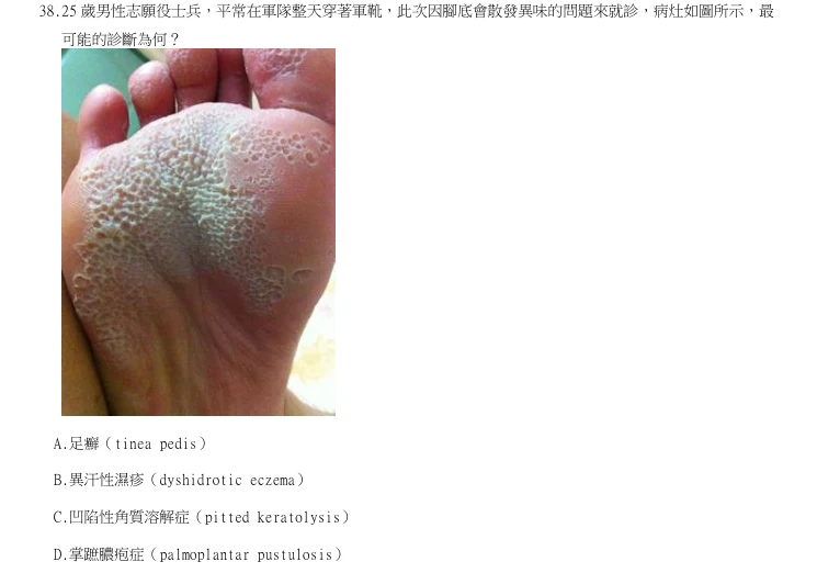 第38題官方原題影像 1
