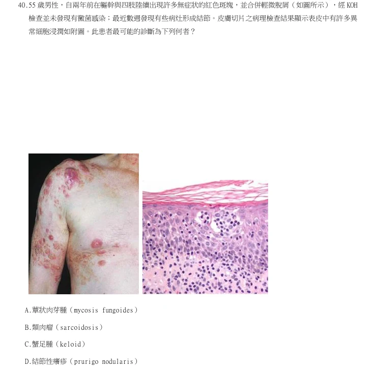 第40題官方原題影像 1