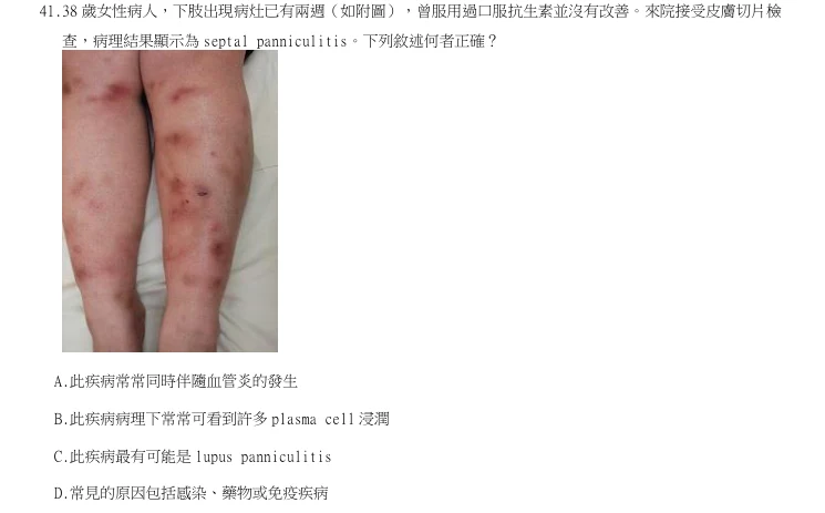 第41題官方原題影像 1