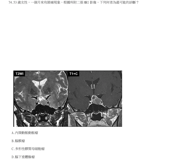 第74題官方原題影像 1