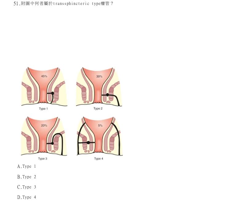 第51題官方原題影像 1