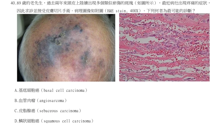 第40題官方原題影像 1
