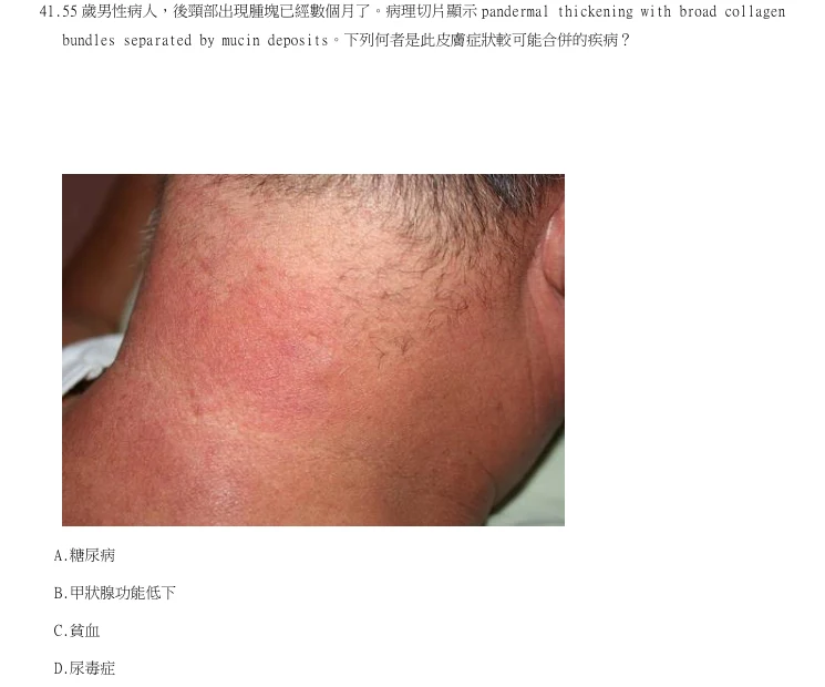 第41題官方原題影像 1