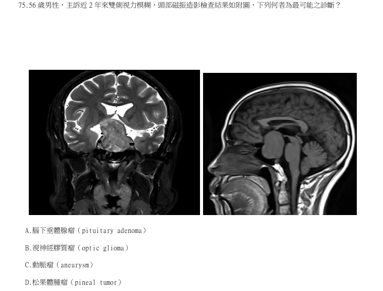 第75題官方原題影像 1
