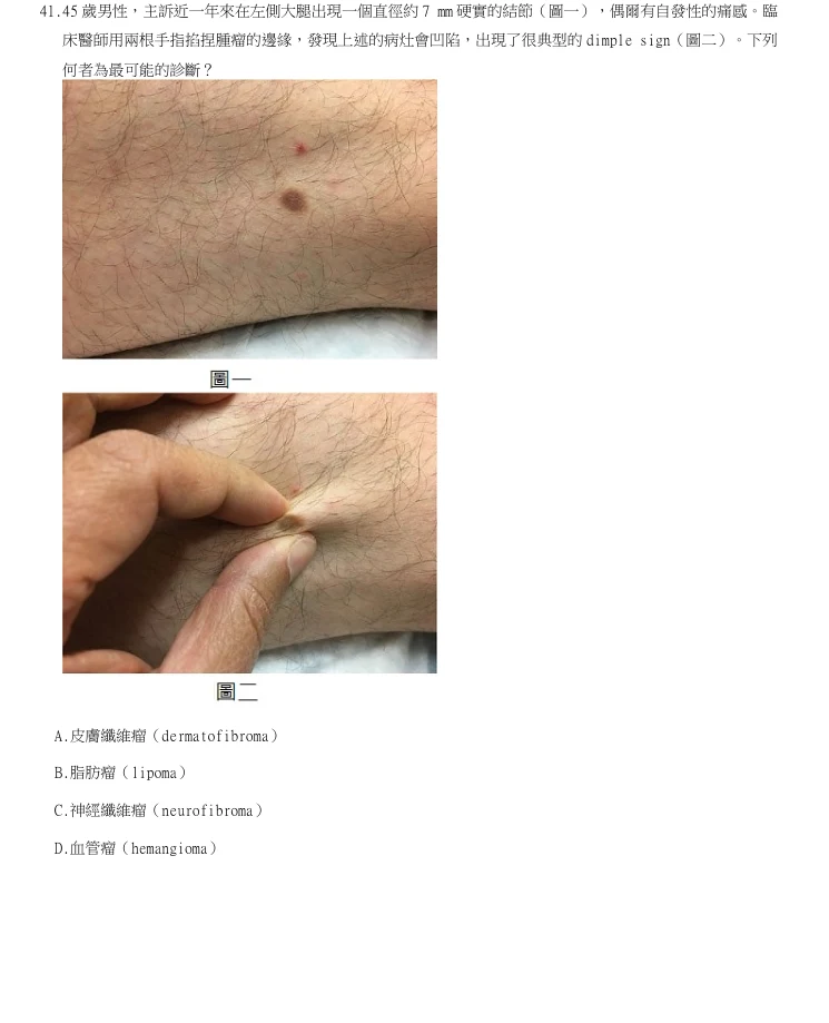 第41題官方原題影像 1