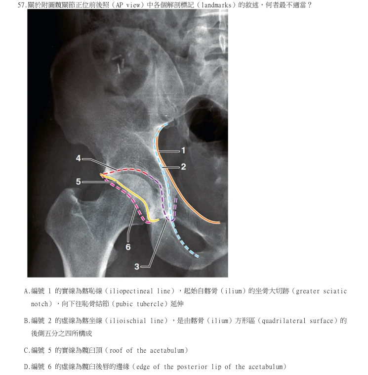 第57題官方原題影像 1