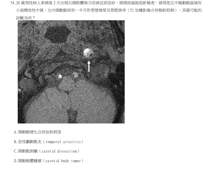 第74題官方原題影像 1
