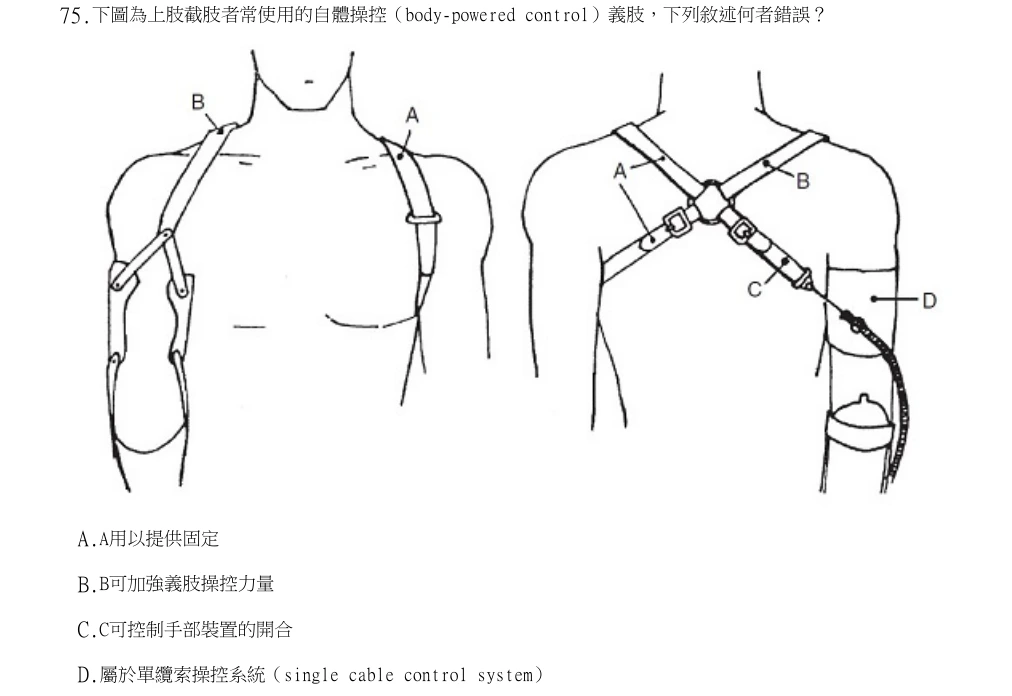 113年第1次物理治療師國考 物理治療技術學(包括電療學、熱療學、操作治療學與輔具學) 第75題原 PDF 題面截圖(含圖像、公式或選項):下圖為上肢截肢者常使用的自體操控(body-powered control)義肢,下列敘述何者錯誤?
